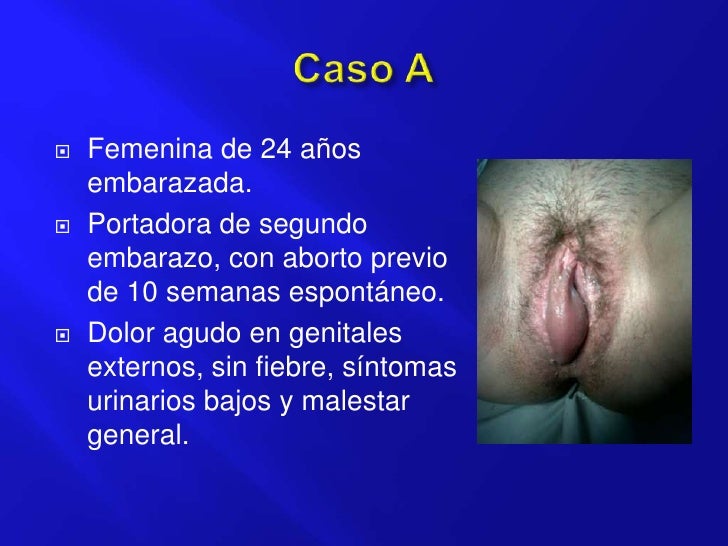 Ha dejado a fumar por que tiempo desaparecen la nicotina