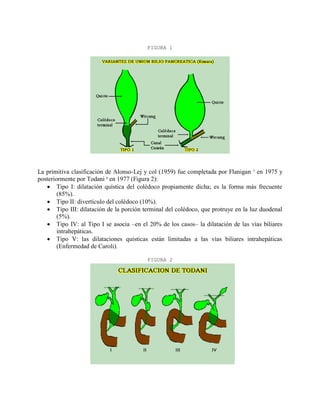 FIGURA 1

La primitiva clasificación de Alonso-Lej y col (1959) fue completada por Flanigan 5 en 1975 y
posteriormente por Todani 6 en 1977 (Figura 2):
 Tipo I: dilatación quística del colédoco propiamente dicha; es la forma más frecuente
(85%).
 Tipo II: divertículo del colédoco (10%).
 Tipo III: dilatación de la porción terminal del colédoco, que protruye en la luz duodenal
(5%).
 Tipo IV: al Tipo I se asocia –en el 20% de los casos– la dilatación de las vías biliares
intrahepáticas.
 Tipo V: las dilataciones quísticas están limitadas a las vías biliares intrahepáticas
(Enfermedad de Caroli).
FIGURA 2

 