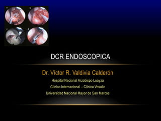 DCR ENDOSCOPICA

Dr. Víctor R. Valdivia Calderón
    Hospital Nacional Arzobispo Loayza
   Clínica Internacional – Clínica Vesalio
 Universidad Nacional Mayor de San Marcos
 