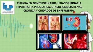 CIRUGIA EN GENITUORINARIO, LITIASIS URINARIA
HIPERTROFIA PROSTATICA, E INSUFICIENCIA RENAL
CRONICA Y CUIDADOS DE ENFERMERIA.
 