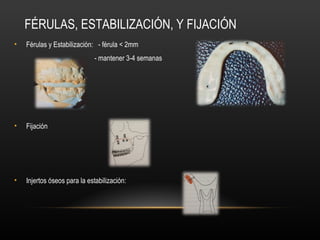 FÉRULAS, ESTABILIZACIÓN, Y FIJACIÓN
• Férulas y Estabilización: - férula < 2mm
- mantener 3-4 semanas
• Fijación
• Injertos óseos para la estabilización:
 