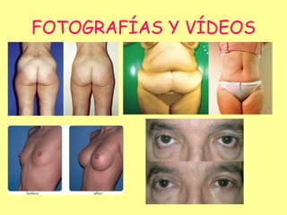 FOTOGRAFÍAS Y VÍDEOS 