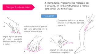 Tiempos fundamentales
2. Hemostasia: Procedimiento realizado por
el cirujano, en forma instrumental o manual
para cohibir una hemorragia:
Dígito-digital: se toma
el vaso sangrante
entre los dedos pulgar
e índice.
Compresión directa: presión
con una compresa en el
sitio de la hemorragia
Compresión indirecta: se ejerce
presión en el trayecto del vaso
sangrante
Digital: presión de un dedo
sobre el vaso sangrante.
Temporal
 