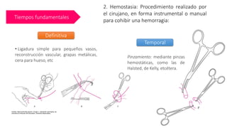 Tiempos fundamentales
2. Hemostasia: Procedimiento realizado por
el cirujano, en forma instrumental o manual
para cohibir una hemorragia:
Temporal
Pinzamiento: mediante pinzas
hemostáticas, como las de
Halsted, de Kelly, etcétera.
• Ligadura simple para pequeños vasos,
reconstrucción vascular, grapas metálicas,
cera para hueso, etc
Definitiva
 
