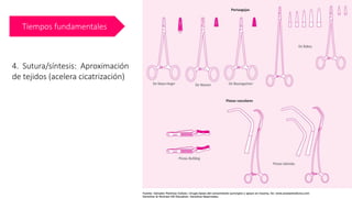 Tiempos fundamentales
4. Sutura/síntesis: Aproximación
de tejidos (acelera cicatrización)
 