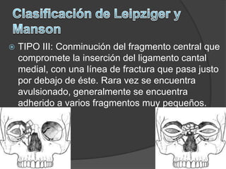 Cirugia Maxilofacial | PPTX