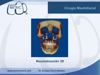 Reconstrucción 3D
www.dentometric.com Dr. Enrique Sierra Rosales
Cirugía Maxilofacial
 