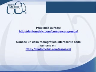 Próximos cursos:
http://dentometric.com/cursos-congresos/
Conoce un caso radiográfico interesante cada
semana en:
http://dentometric.com/casos-rx/
 
