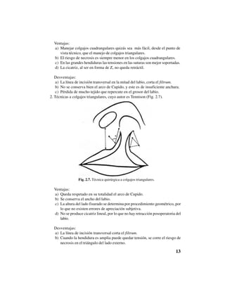 13
Ventajas:
a) Manejar colgajos cuadrangulares quizás sea más fácil, desde el punto de
vista técnico, que el manejo de colgajos triangulares.
b) El riesgo de necrosis es siempre menor en los colgajos cuadrangulares.
c) En las grandes hendiduras las tensiones en las suturas son mejor soportadas.
d) La cicatriz, al ser en forma de Z, no queda retráctil.
Desventajas:
a) La línea de incisión transversal en la mitad del labio, corta el filtrum.
b) No se conserva bien el arco de Cupido, y este es de insuficiente anchura.
c) Pérdida de mucho tejido que repercute en el grosor del labio.
2. Técnicas a colgajos triangulares, cuyo autor es Tennison (Fig. 2.7).
Fig. 2.7. Técnica quirúrgica a colgajos triangulares.
Ventajas:
a) Queda respetado en su totalidad el arco de Cupido.
b) Se conserva el ancho del labio.
c) La altura del lado fisurado se determina por procedimiento geométrico, por
lo que no existen errores de apreciación subjetiva.
d) No se produce cicatriz lineal, por lo que no hay retracción posoperatoria del
labio.
Desventajas:
a) La línea de incisión transversal corta el filtrum.
b) Cuando la hendidura es amplia puede quedar tensión, se corre el riesgo de
necrosis en el triángulo del lado externo.
 