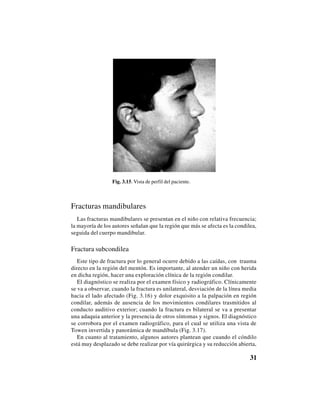 31
Fracturas mandibulares
Las fracturas mandibulares se presentan en el niño con relativa frecuencia;
la mayoría de los autores señalan que la región que más se afecta es la condilea,
seguida del cuerpo mandibular.
Fractura subcondilea
Este tipo de fractura por lo general ocurre debido a las caídas, con trauma
directo en la región del mentón. Es importante, al atender un niño con herida
en dicha región, hacer una exploración clínica de la región condilar.
El diagnóstico se realiza por el examen físico y radiográfico. Clínicamente
se va a observar, cuando la fractura es unilateral, desviación de la línea media
hacia el lado afectado (Fig. 3.16) y dolor exquisito a la palpación en región
condilar, además de ausencia de los movimientos condilares trasmitidos al
conducto auditivo exterior; cuando la fractura es bilateral se va a presentar
una adaquia anterior y la presencia de otros síntomas y signos. El diagnóstico
se corrobora por el examen radiográfico, para el cual se utiliza una vista de
Towen invertida y panorámica de mandíbula (Fig. 3.17).
En cuanto al tratamiento, algunos autores plantean que cuando el cóndilo
está muy desplazado se debe realizar por vía quirúrgica y su reducción abierta,
Fig. 3.15. Vista de perfil del paciente.
 