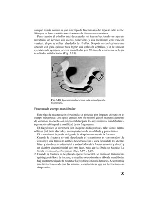 33
aunque lo más común es que este tipo de fractura sea del tipo de tallo verde.
Siempre se han tratado estas fracturas de forma conservadora.
Para cuando el cóndilo está desplazado, se ha confeccionado un aparato
intrabucal de acrílico con calzos posteriores y una mentonera con tracción
vertical, el que se utiliza alrededor de 10 días. Después se confecciona otro
aparato con guía oclusal para lograr una oclusión céntrica, y se le indican
ejercicios de apertura y cierre mandibular por 30 días, de esta forma se logra
resultados satisfactorios (Fig. 3.18).
Fig. 3.18. Aparato intrabucal con guía oclusal para la
fisioterapia.
Fractura de cuerpo mandibular
Este tipo de fractura con frecuencia se produce por impacto directo en el
cuerpo mandibular. Los signos clínicos son los mismos que en el adulto: aumento
de volumen, mal oclusión, imposibilidad para los movimientos mandibulares,
equimosis sublingual y movilidad de los fragmentos.
El diagnóstico se corrobora con imágenes radiográficas, tales como: lateral
oblicua (del lado afectado), anteroposterior de mandíbula y panorámica.
El tratamiento depende del grado de desplazamiento de la fractura:
1. Cuando la fractura no está desplazada el tratamiento es conservador. Se
construye una férula de acrílico fenestrada con la cara oclusal de los dientes
libre, y alambre circunferencial a ambos lados de la fractura (mesial y distal) y
un alambre circunferencial del otro lado, para que la férula no bascule. La
férula se retira a las 5 semanas (Figs. 3.19 y 3.20).
2. Cuando la fractura es desplazada (poco frecuente), se realiza el tratamiento
quirúrgico del foco de fractura, y se realiza osteosíntesis en el borde mandibular,
hay que tener cuidado de no dañar los posibles folículos dentarios. Se construye
una férula fenestrada con las mismas características que en las fracturas no
desplazadas.
 