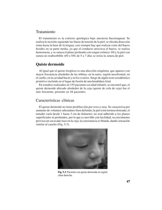 47
Tratamiento
El tratamiento es la exéresis quirúrgica bajo anestesia bucotraqueal. Se
realiza la incisión siguiendo las líneas de tensión de la piel; se efectúa disección
roma hasta la base de la lengua; casi siempre hay que realizar corte del hueso
hioides en su parte media, ya que el conducto atraviesa el hueso; se realiza
hemostasia, y se sutura el plano profundo con catgut crómico 3/0 y la piel con
sutura no reabsorbible 4/0 o 5/0; de 5 a 7 días se retira la sutura de piel.
Quiste dermoide
Al igual que el quiste tirogloso es una afección congénita, que aparece con
mayor frecuencia alrededor de las órbitas, en la nariz, región nasofrontal, en
el cuello, en la cavidad bucal y en los ovarios. Surge de algún resto ectodérmico
primitivo incluido en el lugar de fusión de una hendidura fetal.
En estudios realizados en 155 pacientes en edad infantil, se encontró que, el
quiste dermoide ubicado alrededor de la ceja (quiste de cola de ceja) fue el
más frecuente, presente en 44 pacientes.
Características clínicas
El quiste dermoide no tiene predilección por sexo y raza. Se caracteriza por
aumento de volumen subcutáneo bien definido; la piel está normocoloreada; el
tamaño varía desde 1 hasta 3 cm de diámetro; no está adherido a los planos
superficiales ni profundos, por lo que es movible con facilidad; su crecimiento
provoca un socavado óseo en la ceja; la consistencia es blanda, dando sensación
similar al caucho (Fig. 5.3).
Fig. 5.3. Paciente con quiste dermoide en región
ciliar derecha.
 