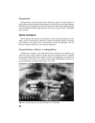 48
Tratamiento
El tratamiento consiste en la exéresis del quiste, que en el niño siempre se
realiza bajo anestesia general (bucotraqueal). La exéresis no constituye ninguna
dificultad y en el momento de realizar la incisión se debe tener cuidado de que
esta sea paralela al borde superoexterno de la ceja, lo que evita la visibilidad
de la cicatriz.
Quiste dentígero
De los quistes que afectan los maxilares es el de mayor frecuencia. En los
niños, por las características del hueso, tienen crecimiento rápido y alcanzan
gran tamaño. Los dientes que con frecuencia están involucrados, son los
terceros molares inferiores y los caninos superiores.
Características clínicas y radiográficas
Aumento de volumen por expansión de las corticales, que cuando es en
zona del tercer molar inferior, puede provocar asimetría facial; también
provocan desplazamiento de los dientes vecinos. A la palpación, la consistencia
es renitente. A los rayos X se observa una imagen radiolúcida asociada a la
corona del diente no erupcionado (Figs. 5.4 y 5.5).
Fig. 5.4. Vista panorámica de un quiste dentígero en la mandíbula.
 