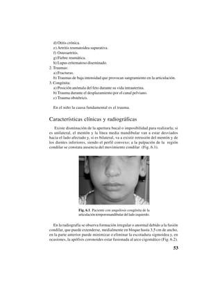 53
d) Otitis crónica.
e) Artritis reumatoidea supurativa.
f) Osteoartritis.
g) Fiebre reumática.
h) Lupus eritematoso diseminado.
2. Traumas:
a) Fracturas.
b) Traumas de baja intensidad que provocan sangramiento en la articulación.
3. Congénita:
a) Posición anómala del feto durante su vida intrauterina.
b) Trauma durante el desplazamiento por el canal pelviano.
c) Trauma obstétrico.
En el niño la causa fundamental es el trauma.
Características clínicas y radiográficas
Existe disminución de la apertura bucal o imposibilidad para realizarla; si
es unilateral, el mentón y la línea media mandibular van a estar desviados
hacia el lado afectado y, si es bilateral, va a existir retrusión del mentón y de
los dientes inferiores, siendo el perfil convexo; a la palpación de la región
condilar se constata ausencia del movimiento condilar (Fig. 6.1).
Fig. 6.1. Paciente con anquilosis congénita de la
articulación temporomandibular del lado izquierdo.
En la radiografía se observa formación irregular o anormal debido a la fusión
condilar, que puede extenderse, medialmente en bloque hasta 3,5 cm de ancho,
en la parte anterior puede minimizar o eliminar la escotadura sigmoidea y, en
ocasiones, la apófisis coronoides estar fusionada al arco cigomático (Fig. 6.2).
 