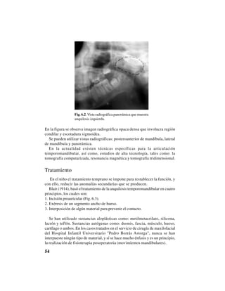 54
En la figura se observa imagen radiográfica opaca densa que involucra región
condilar y escotadura sigmoidea.
Se pueden utilizar vistas radiográficas: posteroanterior de mandíbula, lateral
de mandíbula y panorámica.
En la actualidad existen técnicas específicas para la articulación
temporomandibular, así como, estudios de alta tecnología, tales como: la
tomografía computarizada, resonancia magnética y tomografía tridimensional.
Tratamiento
En el niño el tratamiento temprano se impone para restablecer la función, y
con ello, reducir las anomalías secundarias que se producen.
Blair (1914), basó el tratamiento de la anquilosis temporomandibular en cuatro
principios, los cuales son:
1. Incisión preauricular (Fig. 6.3).
2. Exéresis de un segmento ancho de hueso.
3. Interposición de algún material para prevenir el contacto.
Se han utilizado sustancias aloplásticas como: metilmetacrilato, silicona,
lacrón y teflón. Sustancias autógenas como: dermis, fascia, músculo, hueso,
cartílago o ambos. En los casos tratados en el servicio de cirugía de maxilofacial
del Hospital Infantil Universitario "Pedro Borrás Astorga", nunca se han
interpuesto ningún tipo de material, y sí se hace mucho énfasis y es un principio,
la realización de fisioterapia posoperatoria (movimientos mandibulares).
Fig. 6.2. Vista radiográfica panorámica que muestra
anquilosis izquierda.
 