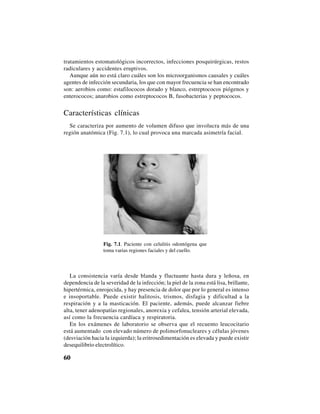 60
tratamientos estomatológicos incorrectos, infecciones posquirúrgicas, restos
radiculares y accidentes eruptivos.
Aunque aún no está claro cuáles son los microorganismos causales y cuáles
agentes de infección secundaria, los que con mayor frecuencia se han encontrado
son: aerobios como: estafilococos dorado y blanco, estreptococos piógenos y
enterococos; anarobios como estreptococos B, fusobacterias y peptococos.
Características clínicas
Se caracteriza por aumento de volumen difuso que involucra más de una
región anatómica (Fig. 7.1), lo cual provoca una marcada asimetría facial.
Fig. 7.1. Paciente con celulitis odontógena que
toma varias regiones faciales y del cuello.
La consistencia varía desde blanda y fluctuante hasta dura y leñosa, en
dependencia de la severidad de la infección; la piel de la zona está lisa, brillante,
hipertérmica, enrojecida, y hay presencia de dolor que por lo general es intenso
e insoportable. Puede existir halitosis, trismos, disfagia y dificultad a la
respiración y a la masticación. El paciente, además, puede alcanzar fiebre
alta, tener adenopatías regionales, anorexia y cefalea, tensión arterial elevada,
así como la frecuencia cardíaca y respiratoria.
En los exámenes de laboratorio se observa que el recuento leucocitario
está aumentado con elevado número de polimorfonucleares y células jóvenes
(desviación hacia la izquierda); la eritrosedimentación es elevada y puede existir
desequilibrio electrolítico.
 
