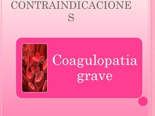 CONTRAINDICACIONE
S

 