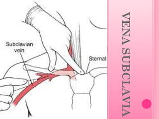 VENA SUBCLAVIA

 