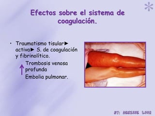 Efectos sobre el sistema de
coagulación.
• Traumatismo tisular►
activa► S. de coagulación
y fibrinolítico.
Trombosis venosa
profunda
Embolia pulmonar.
 