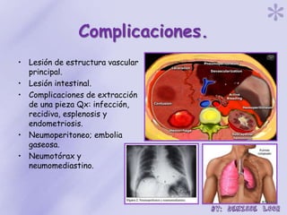 Complicaciones.
• Lesión de estructura vascular
principal.
• Lesión intestinal.
• Complicaciones de extracción
de una pieza Qx: infección,
recidiva, esplenosis y
endometriosis.
• Neumoperitoneo; embolia
gaseosa.
• Neumotórax y
neumomediastino.
 