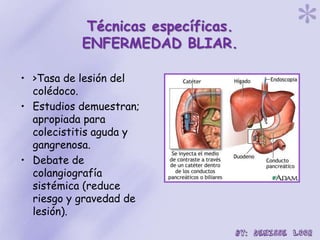 Técnicas específicas.
ENFERMEDAD BLIAR.
• >Tasa de lesión del
colédoco.
• Estudios demuestran;
apropiada para
colecistitis aguda y
gangrenosa.
• Debate de
colangiografía
sistémica (reduce
riesgo y gravedad de
lesión).
 