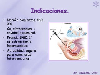 Indicaciones.
• Nació a comienzos siglo
XX.
Cx, cistoscopios→
cavidad abdominal.
• Francia 1985, 1°
colecistectomía
laparoscópica.
• Actualidad, segura
para numerosas
intervenciones.
 