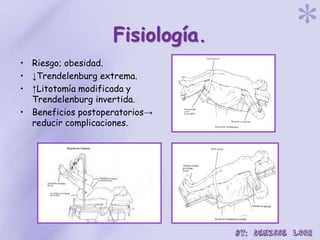 Fisiología.
• Riesgo; obesidad.
• ↓Trendelenburg extrema.
• ↑Litotomía modificada y
Trendelenburg invertida.
• Beneficios postoperatorios→
reducir complicaciones.
 