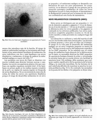 CLINICA QUIRURGICA - Cirugia pediatrica   ashcraft