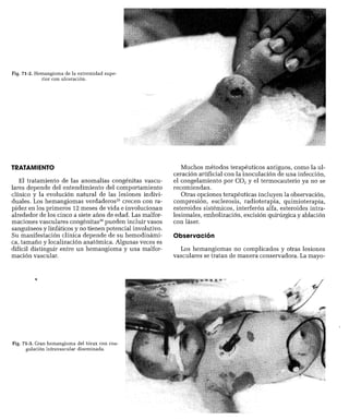CLINICA QUIRURGICA - Cirugia pediatrica   ashcraft