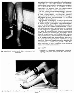CLINICA QUIRURGICA - Cirugia pediatrica   ashcraft