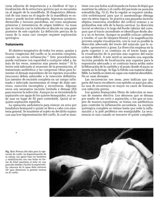 CLINICA QUIRURGICA - Cirugia pediatrica   ashcraft