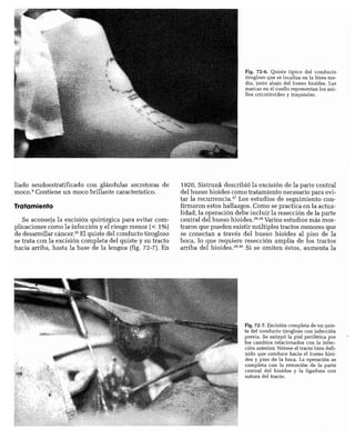 CLINICA QUIRURGICA - Cirugia pediatrica   ashcraft