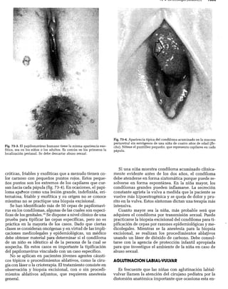 CLINICA QUIRURGICA - Cirugia pediatrica   ashcraft