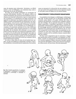 CLINICA QUIRURGICA - Cirugia pediatrica   ashcraft