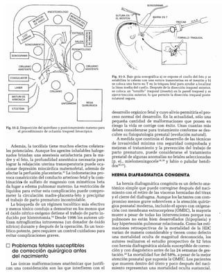 CLINICA QUIRURGICA - Cirugia pediatrica   ashcraft
