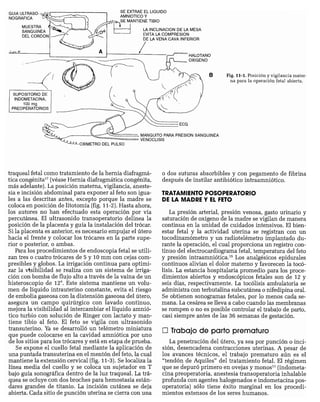 CLINICA QUIRURGICA - Cirugia pediatrica   ashcraft
