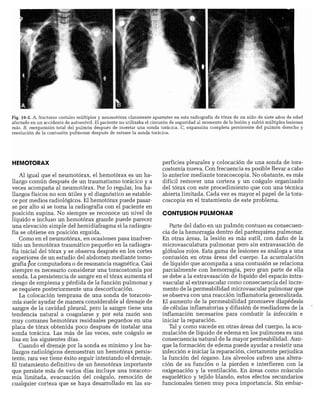 CLINICA QUIRURGICA - Cirugia pediatrica   ashcraft