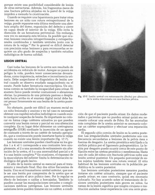 CLINICA QUIRURGICA - Cirugia pediatrica   ashcraft