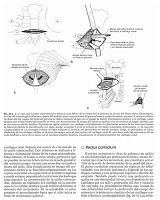 CLINICA QUIRURGICA - Cirugia pediatrica   ashcraft