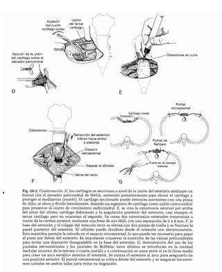 CLINICA QUIRURGICA - Cirugia pediatrica   ashcraft
