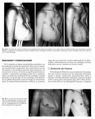 CLINICA QUIRURGICA - Cirugia pediatrica   ashcraft