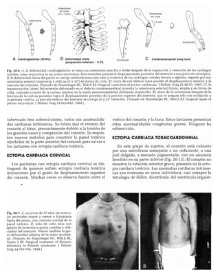 CLINICA QUIRURGICA - Cirugia pediatrica   ashcraft