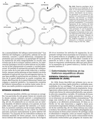 CLINICA QUIRURGICA - Cirugia pediatrica   ashcraft