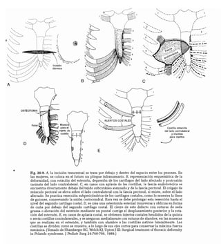CLINICA QUIRURGICA - Cirugia pediatrica   ashcraft