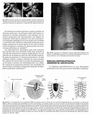 CLINICA QUIRURGICA - Cirugia pediatrica   ashcraft