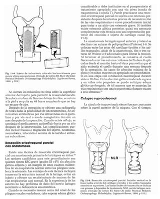 CLINICA QUIRURGICA - Cirugia pediatrica   ashcraft