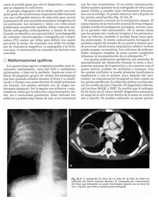 CLINICA QUIRURGICA - Cirugia pediatrica   ashcraft