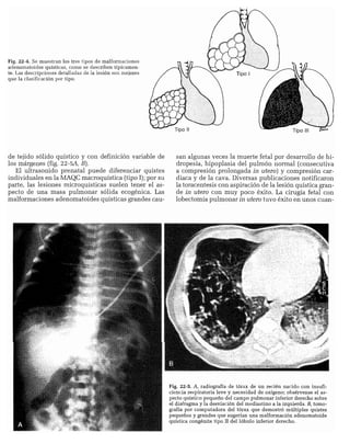 CLINICA QUIRURGICA - Cirugia pediatrica   ashcraft