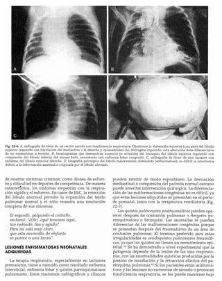 CLINICA QUIRURGICA - Cirugia pediatrica   ashcraft