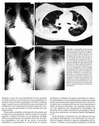 CLINICA QUIRURGICA - Cirugia pediatrica   ashcraft